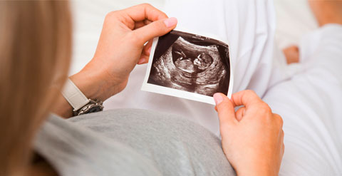 Bilder einer schwangeren Frau die ein Ultraschallfoto Ihres Embryos in den Händen hält.